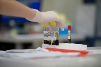 Steeds meer Nederlanders testen hun bloed zonder huisarts